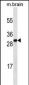 HMGB1 Antibody (C-term) (Ascites)
